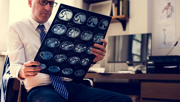 Brain Injury Solicitors